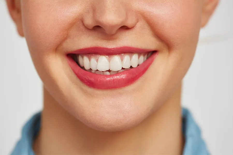 لبخند و دندان‌ها