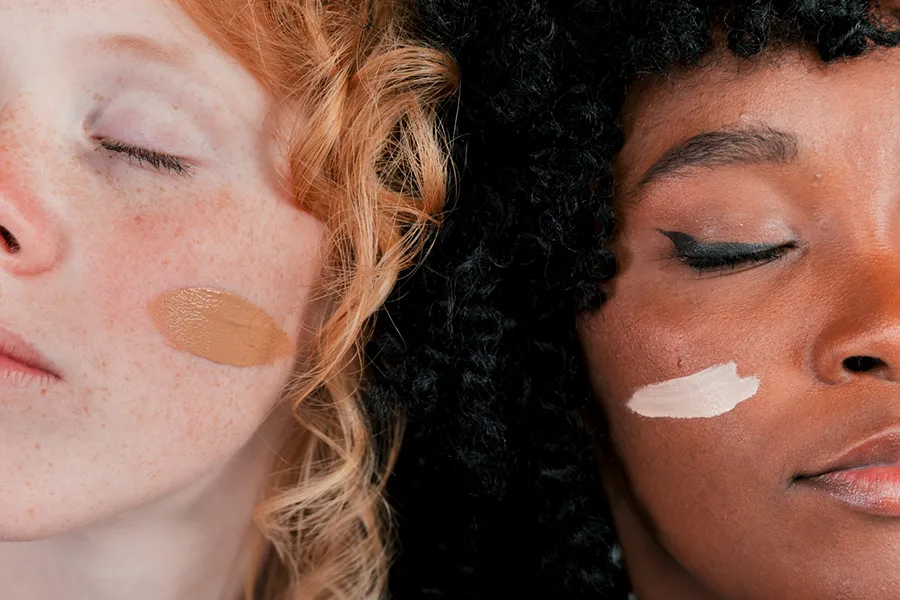 رفع تیرگی پوست با ترفندهای ساده خانگی✨ 1 انواع تیرگی پوست