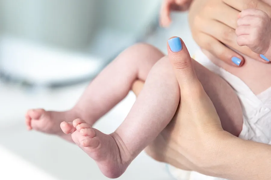 درمان کولیک نوزاد | راهنمای کامل برای آرامش نوزاد و والدین👶 4 نکات طلایی در تغذیه مادران شیرده